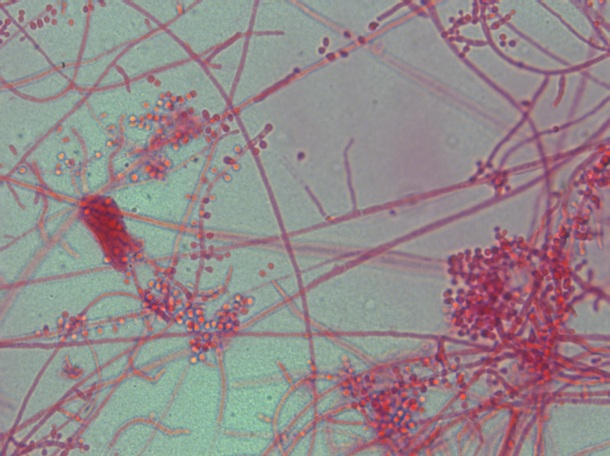 Trichophyton spp. Life Worldwide ES